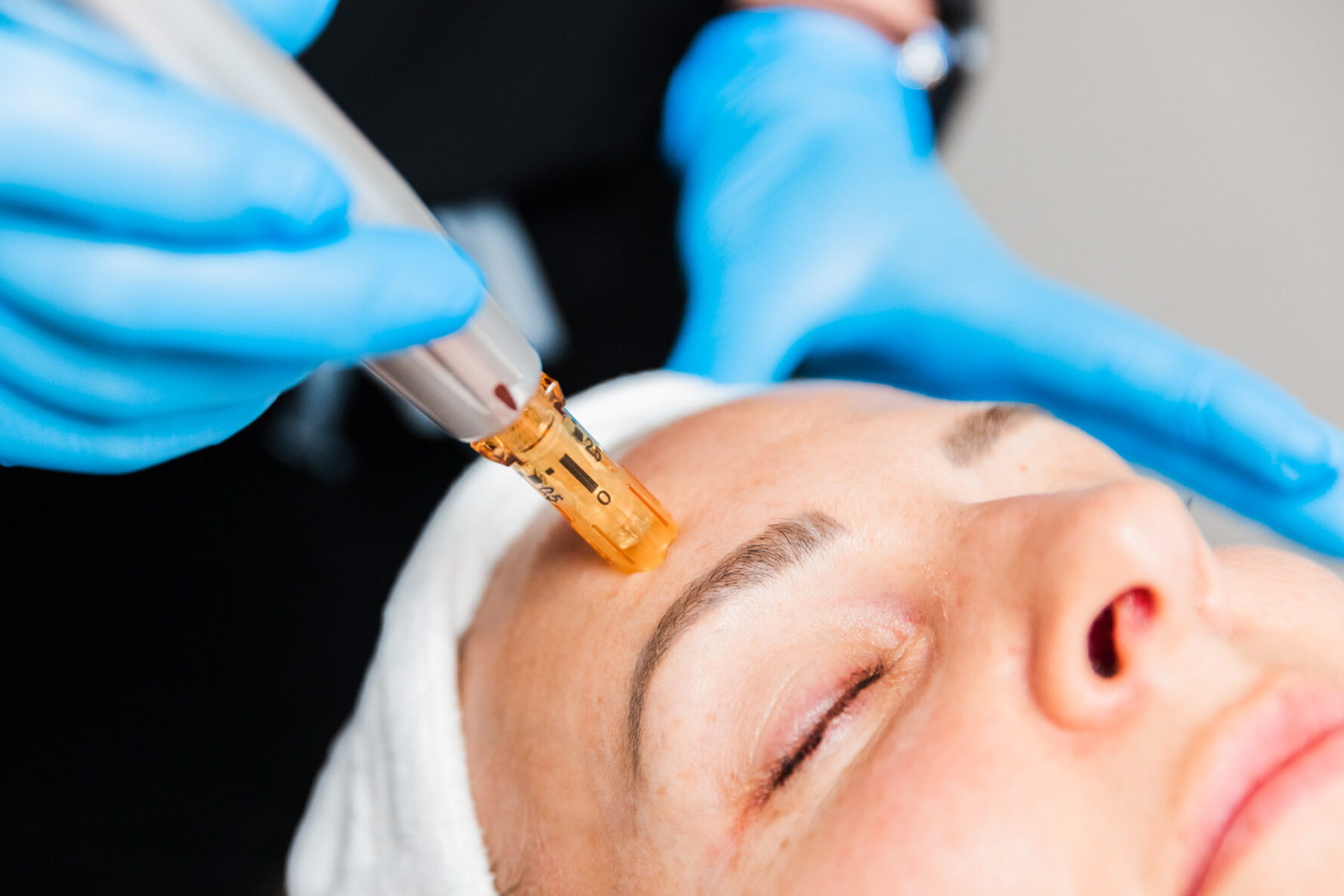 Rejuvapen Microneedling - Restoration Wellness And Medspa